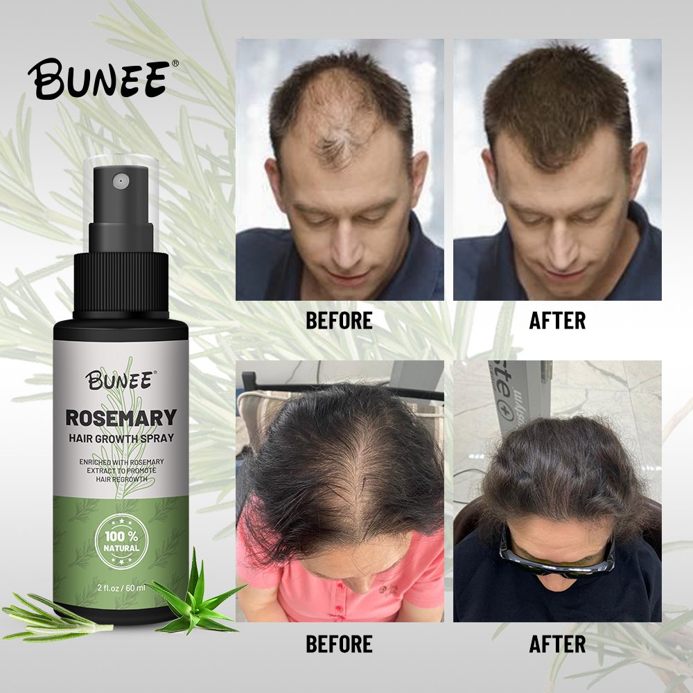 Hot sale rosemary hair growth liquid spray hair loss treatments eaasential oil serum hair regrowth tonics