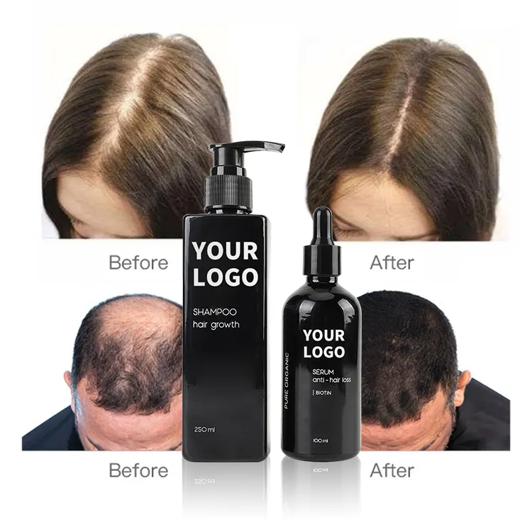 hair growth shampoo and conditioner