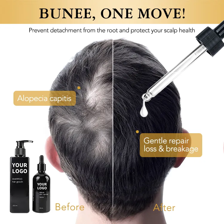 hair growth shampoo and conditioner