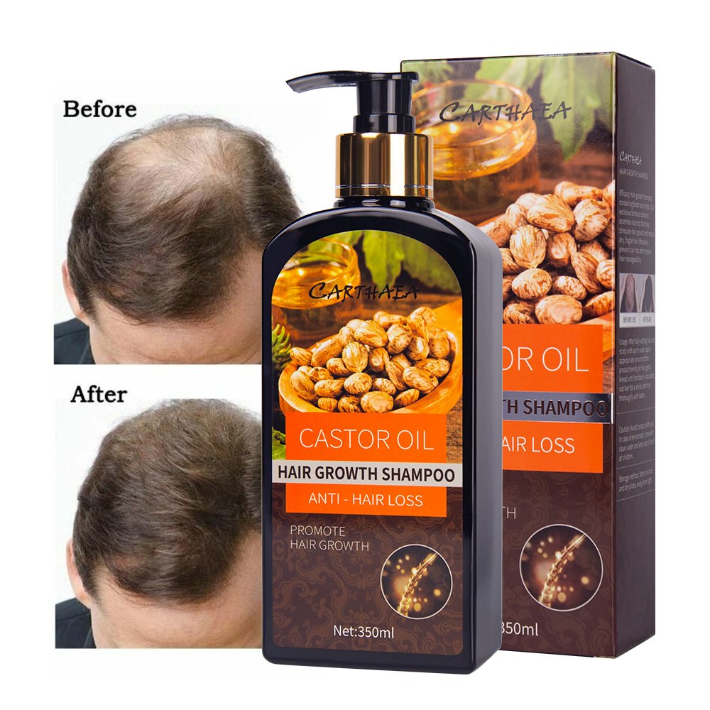 Private Label Natural hair products Moisturizing Anti loss care Vegan Biotin castor oil hair growth shampoo