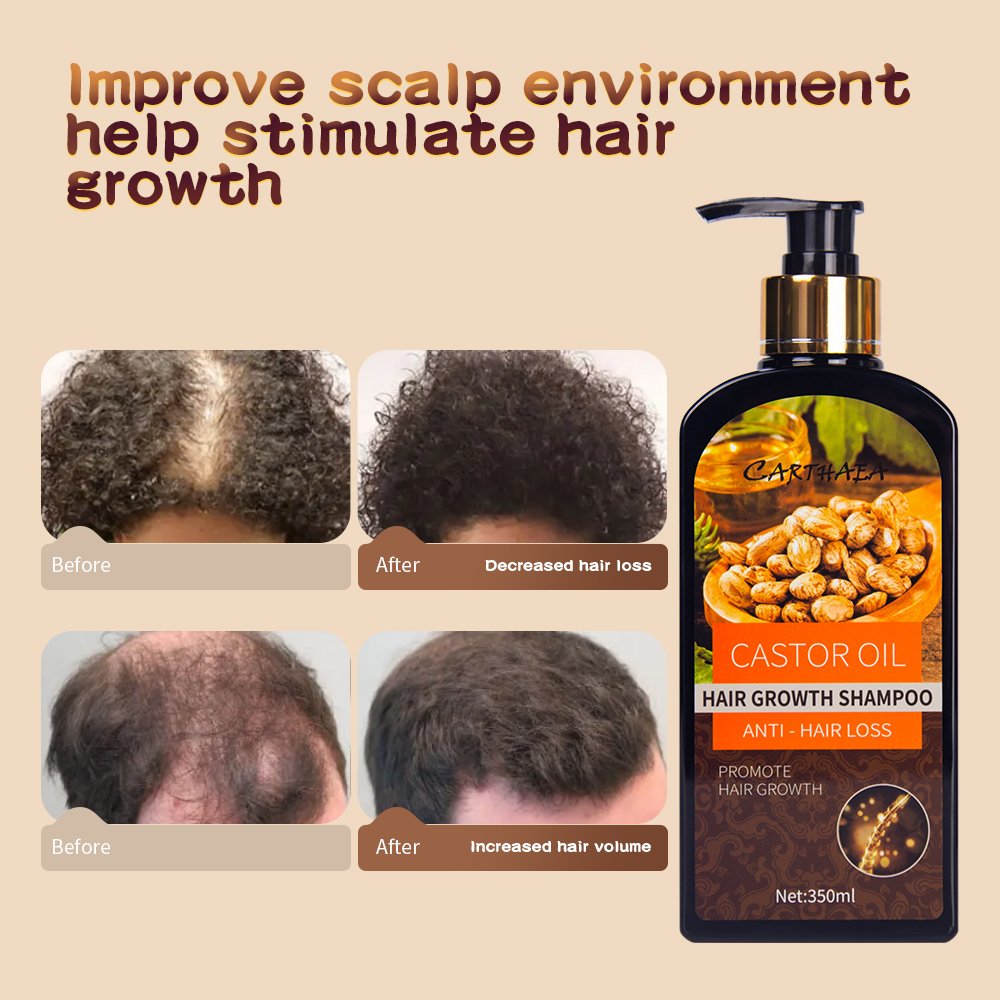 Private Label Natural hair products Moisturizing Anti loss care Vegan Biotin castor oil hair growth shampoo