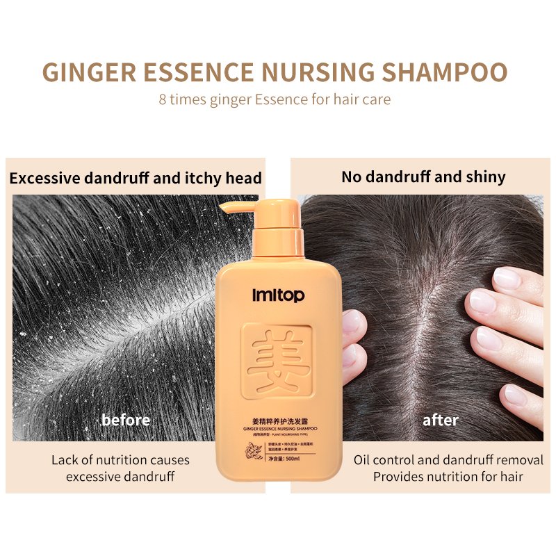 King Ginger Hair Care Shampoo And Conditioner Set For Women Sulfate Free Ginger Plant Extract Anti-Hair Loss Hair Shampoo