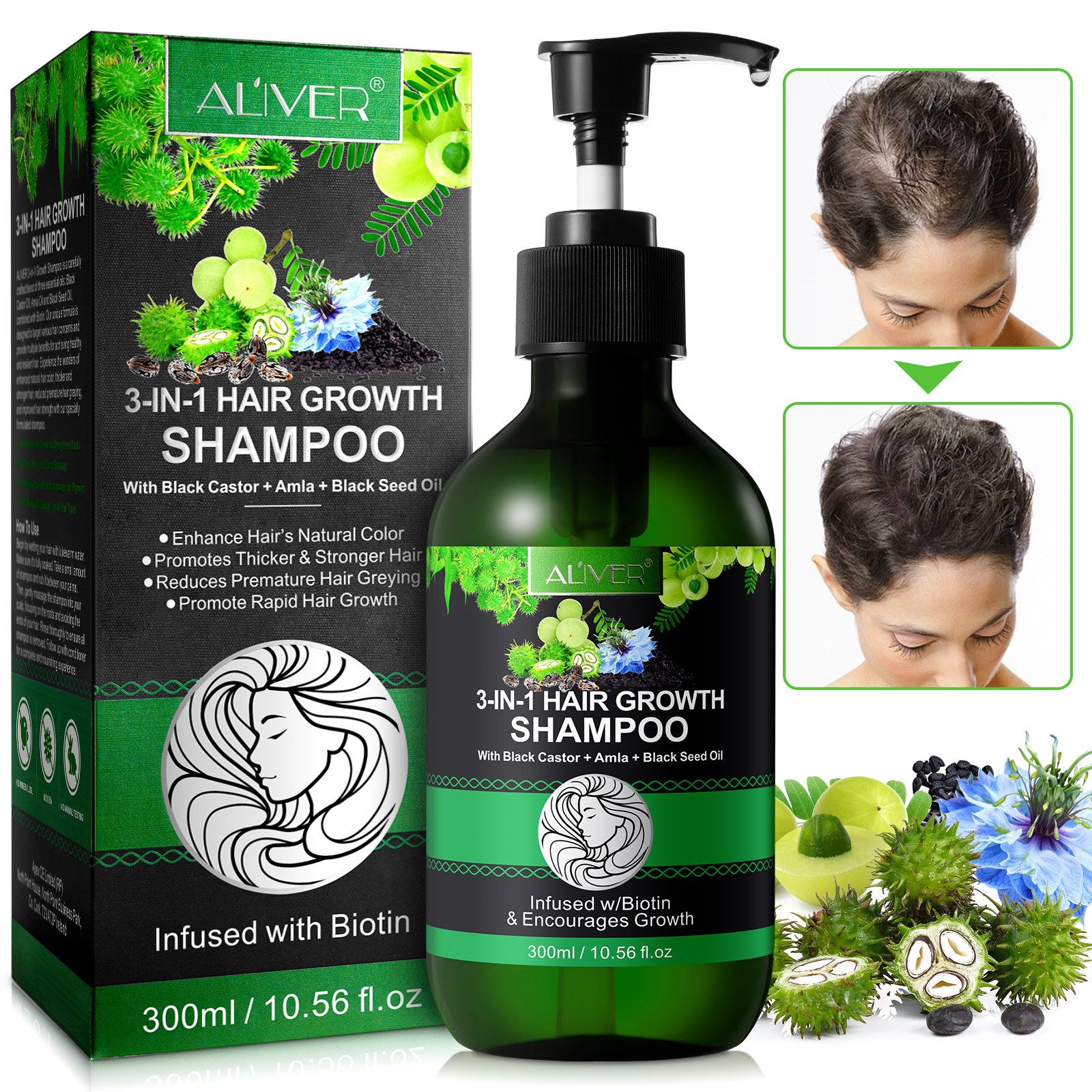 ALIVER private label enhance natural color 300ml hair loss biotin hair growth jamaican black castor amla black seed oil shampoo