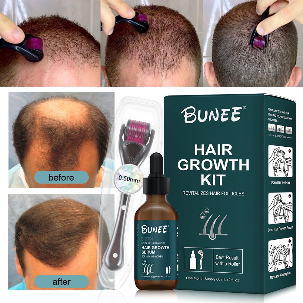 Professional Manufacturer repair hair growth anti loss serum alopeciae treatment hair regrowth tonics kit with low moq