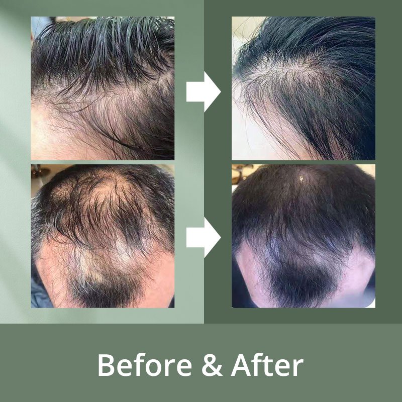 Organic 60ml Ginger Extract Anti Hair Loss Treatment Serum Easy to Carry for Damaged Hair Herbal Gel