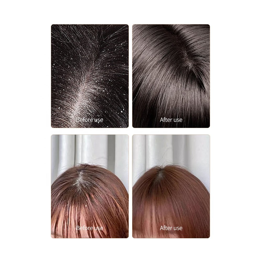 Private label OEM rosemary hair shampoo mens 2 in 1 shampoo