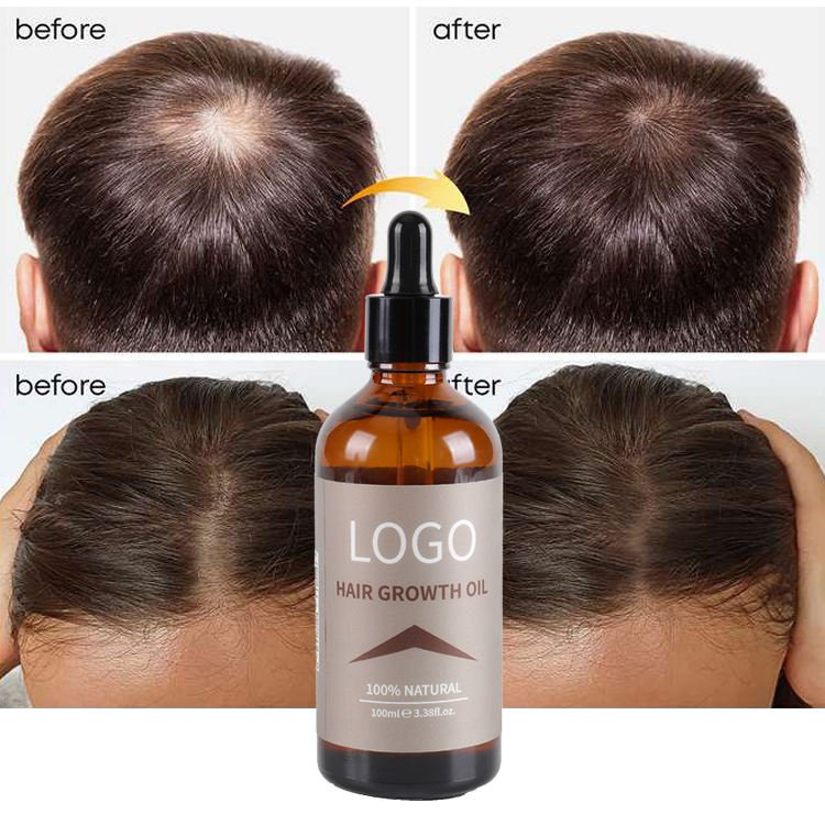 Private Label OEM Custom logo 100% Natural Organic Rosemary Castor Almond Hair Growth Shampoo and Conditioner