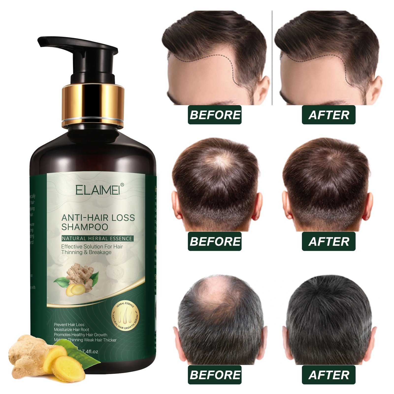 Custom Logo Anti Hair Loss Moisturizing Ginger Shampoo and Conditioner with Gineng Extract for Black Hair Growth