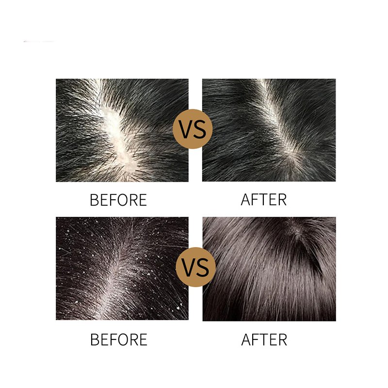 Moisturizing hair care refreshing scalp and oil control chinese shampoo hair products shea moisture shampoo coconut oil