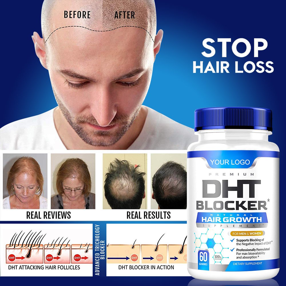DHT Blocker Hair Growth Support Supplement Supports Healthy Hair Growth Thicker Stronger Hair High Potency Biotin Saw Palmetto