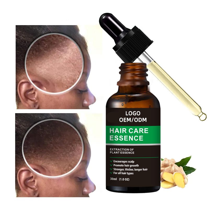 OEM Fast 7days Private Label Organic Natural Ginger Hair Growth Oil Serum Hair Regrowth Tonic