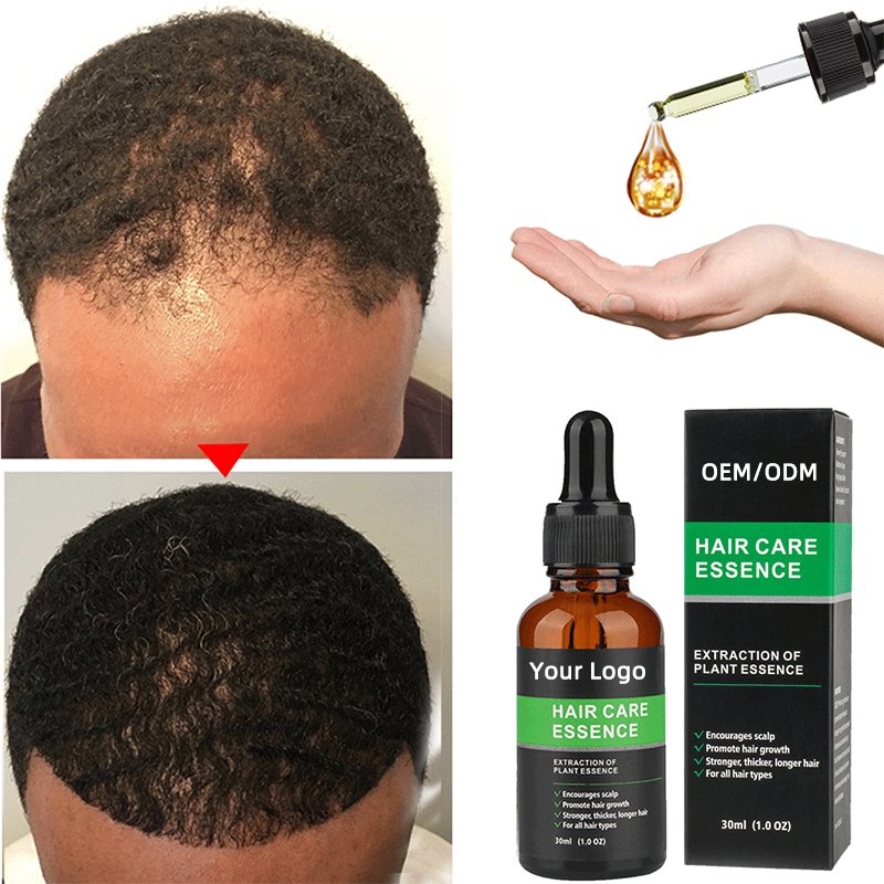 OEM Fast 7days Private Label Organic Natural Ginger Hair Growth Oil Serum Hair Regrowth Tonic