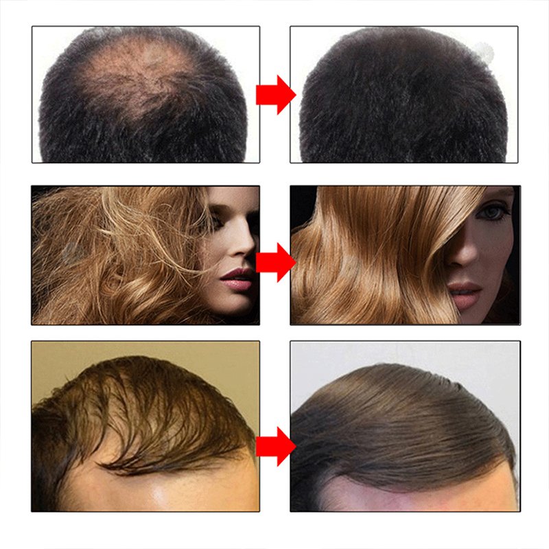 OEM Fast 7days Private Label Organic Natural Ginger Hair Growth Oil Serum Hair Regrowth Tonic