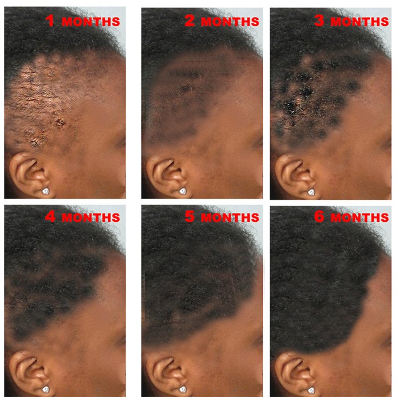OEM Fast 7days Private Label Organic Natural Ginger Hair Growth Oil Serum Hair Regrowth Tonic