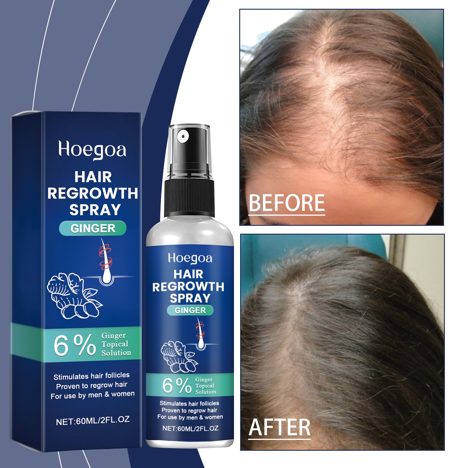 Hoegoa Hair Regrowth Products Ginger Hair Regrowth Liquid Booster Hair Regrowth Spray