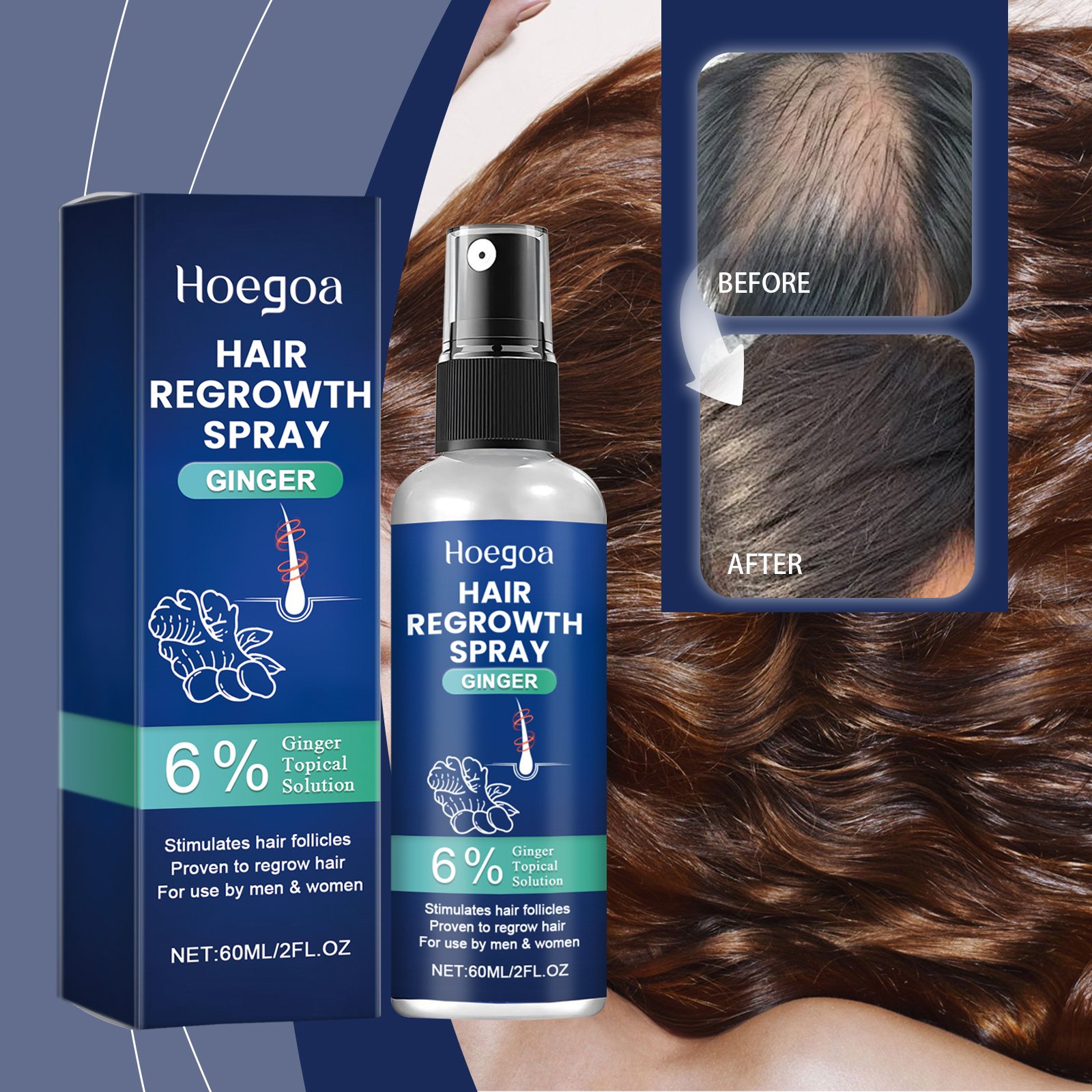 Hoegoa Hair Regrowth Products Ginger Hair Regrowth Liquid Booster Hair Regrowth Spray