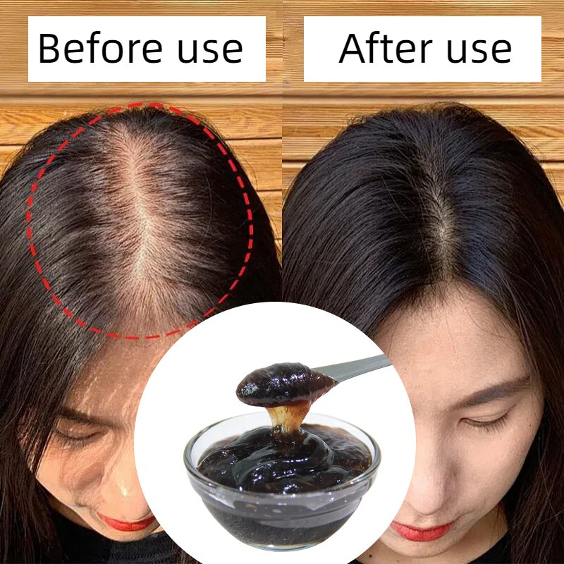 Private Label Hair Care Anti-hair Loss Anti-dandruff And Oil-control Polygonum Multiflorum Black Hair Fluffy Nourishing Shampoo
