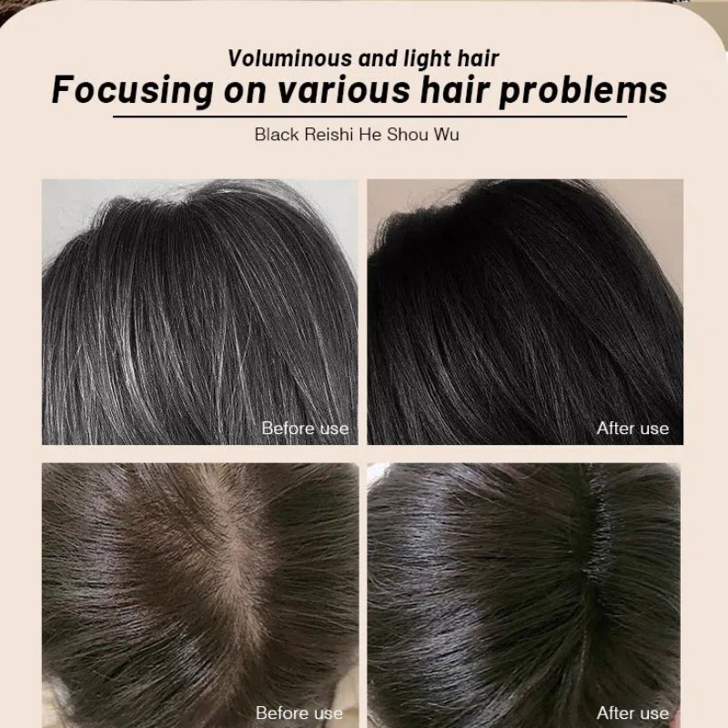 Private Label Hair Care Anti-hair Loss Anti-dandruff And Oil-control Polygonum Multiflorum Black Hair Fluffy Nourishing Shampoo