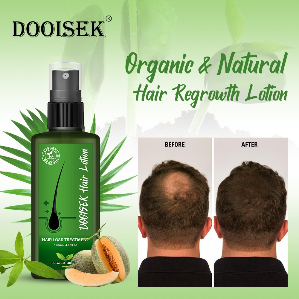 New Arrivals Hair Lotion regrowth serum hair growth essence spray nourish hair roots Genuine Original alopeciae treatment