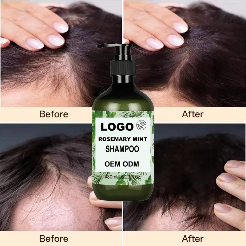 SANQI Factory Oem Natural Organic Custom Vegan Hair Loss Rosemary Mint Tea Tree Oil Hair Growth Shampoo And Conditioner Set