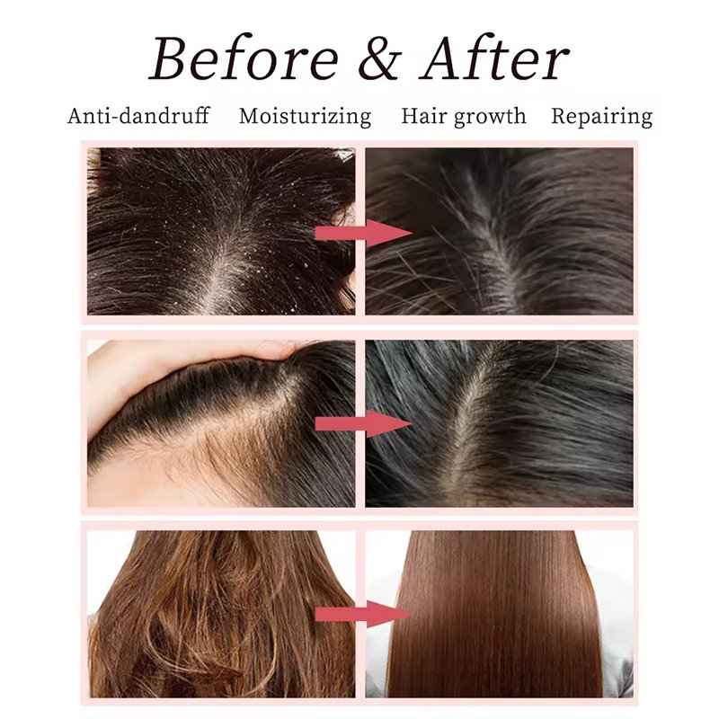 SANQI Factory Oem Natural Organic Custom Vegan Hair Loss Rosemary Mint Tea Tree Oil Hair Growth Shampoo And Conditioner Set