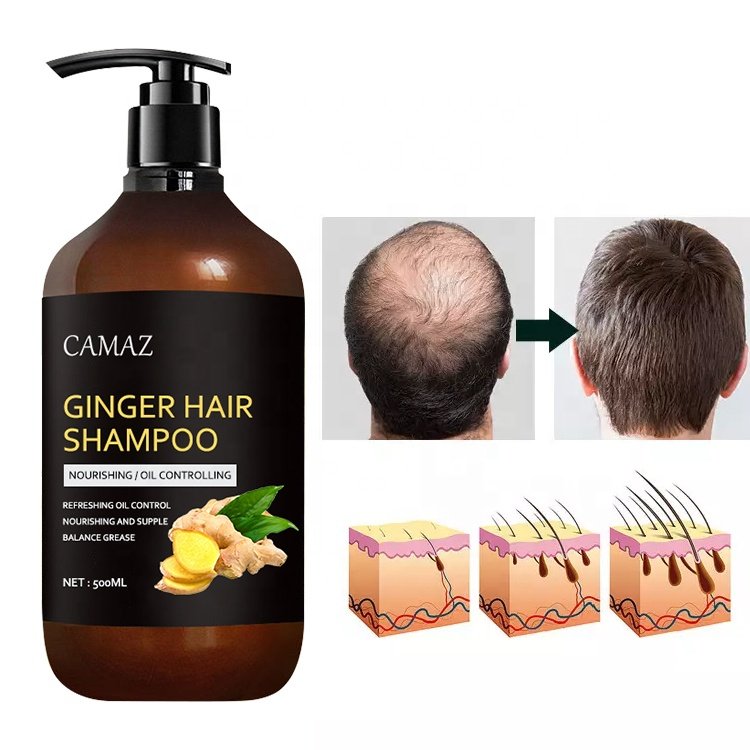 Ginger Shampoo hair growth products Organic Anti Hair Loss head and shoulder Ginger Hair Shampoo