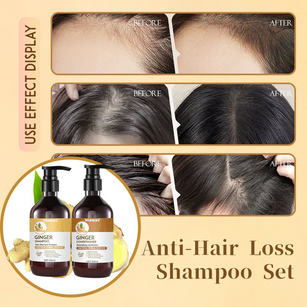 OEM 300 ml Ginger Hair Shampoo Oil Control Anti-hair Loss Hair Care Shampoo And Conditioner Wholesale