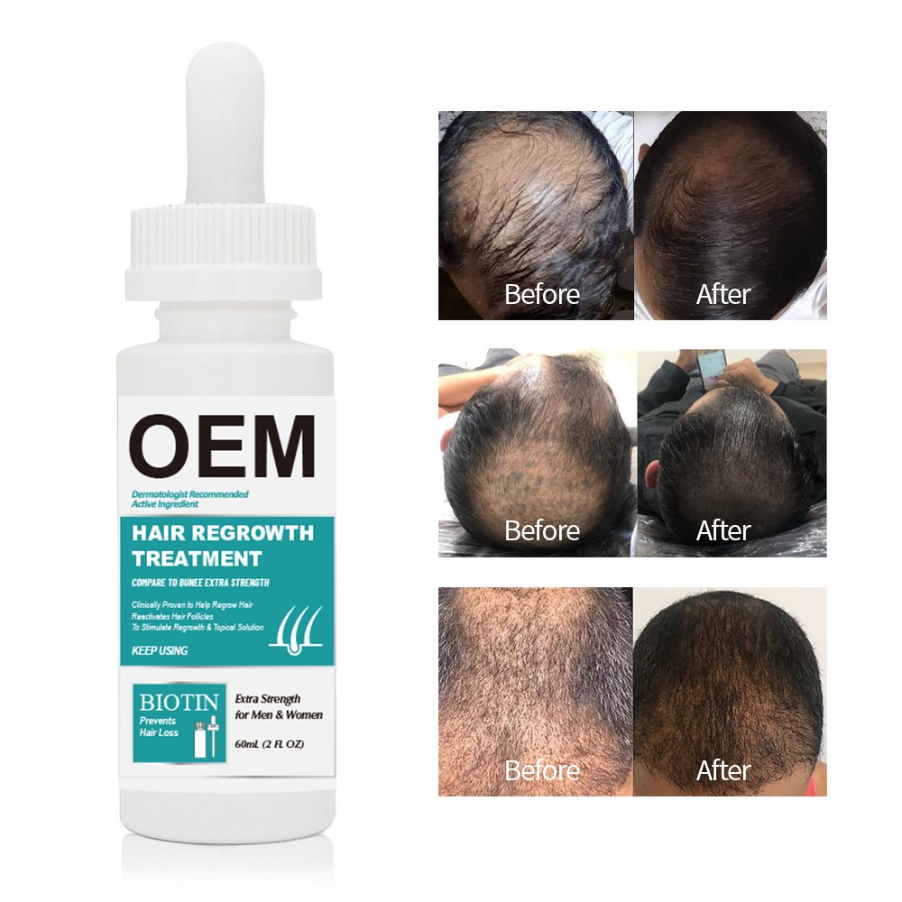 Private brand 60ml Biotin Collagen Hair Loss Regrowth hair tonic growth spray hair serum