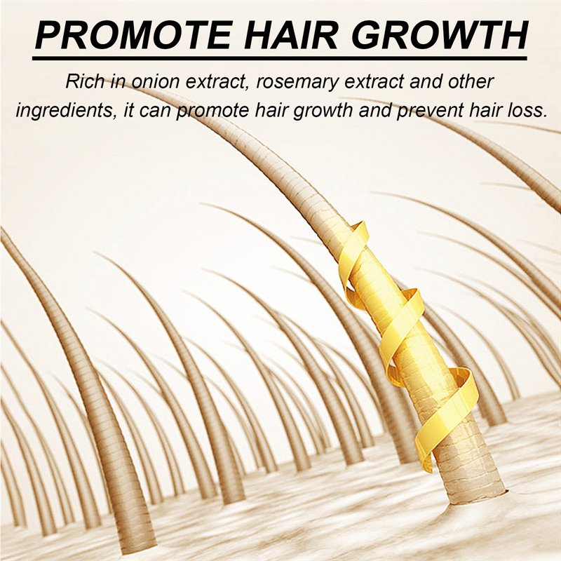 OUHOE 200ml onion biotin shampoo conditioner set moisturizing anti loss growth promoting rosemary shampoo and conditioner set