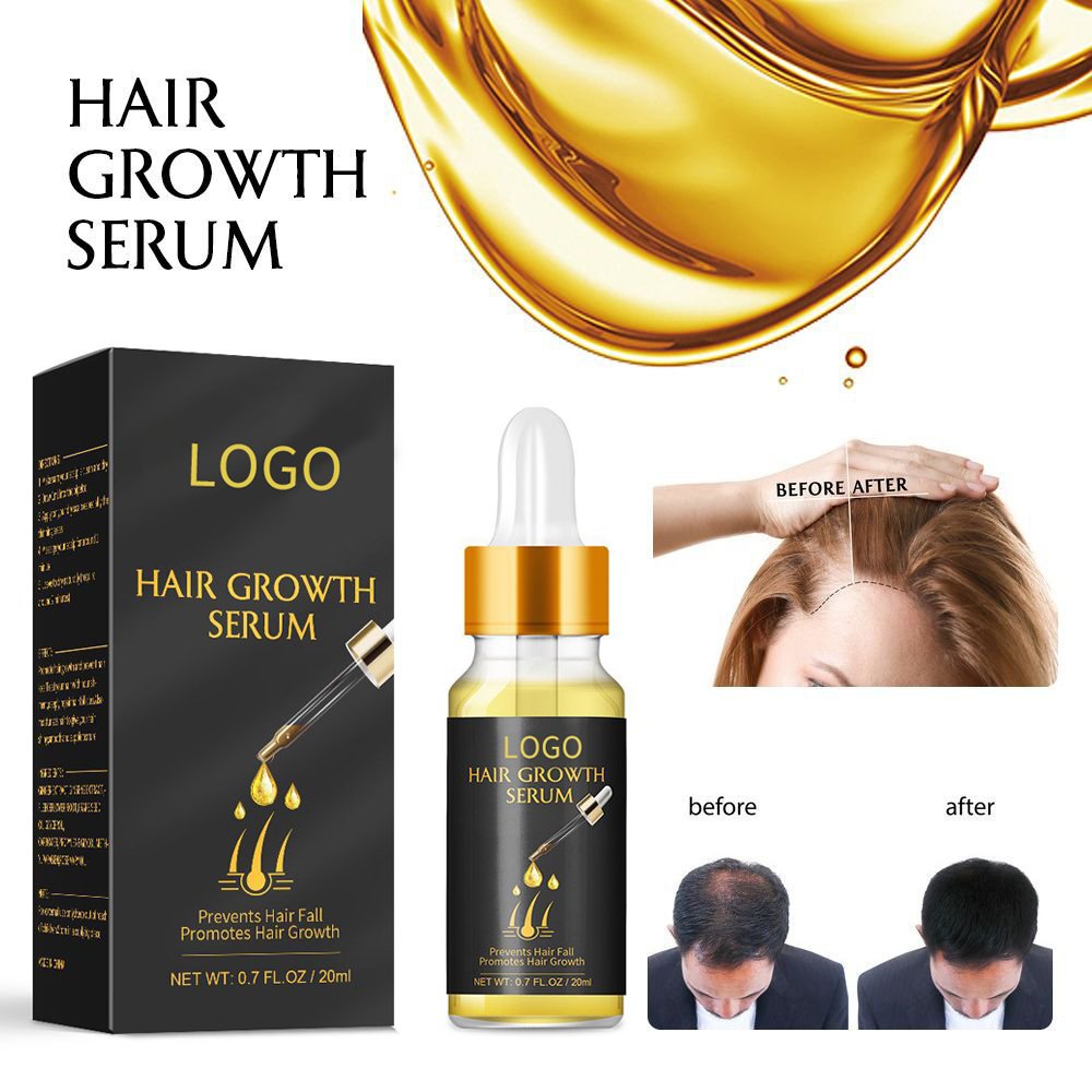 ShangMei OEM dropper glass bottle hair growth oil organic serum tonic natural softee hair growth oil Serum