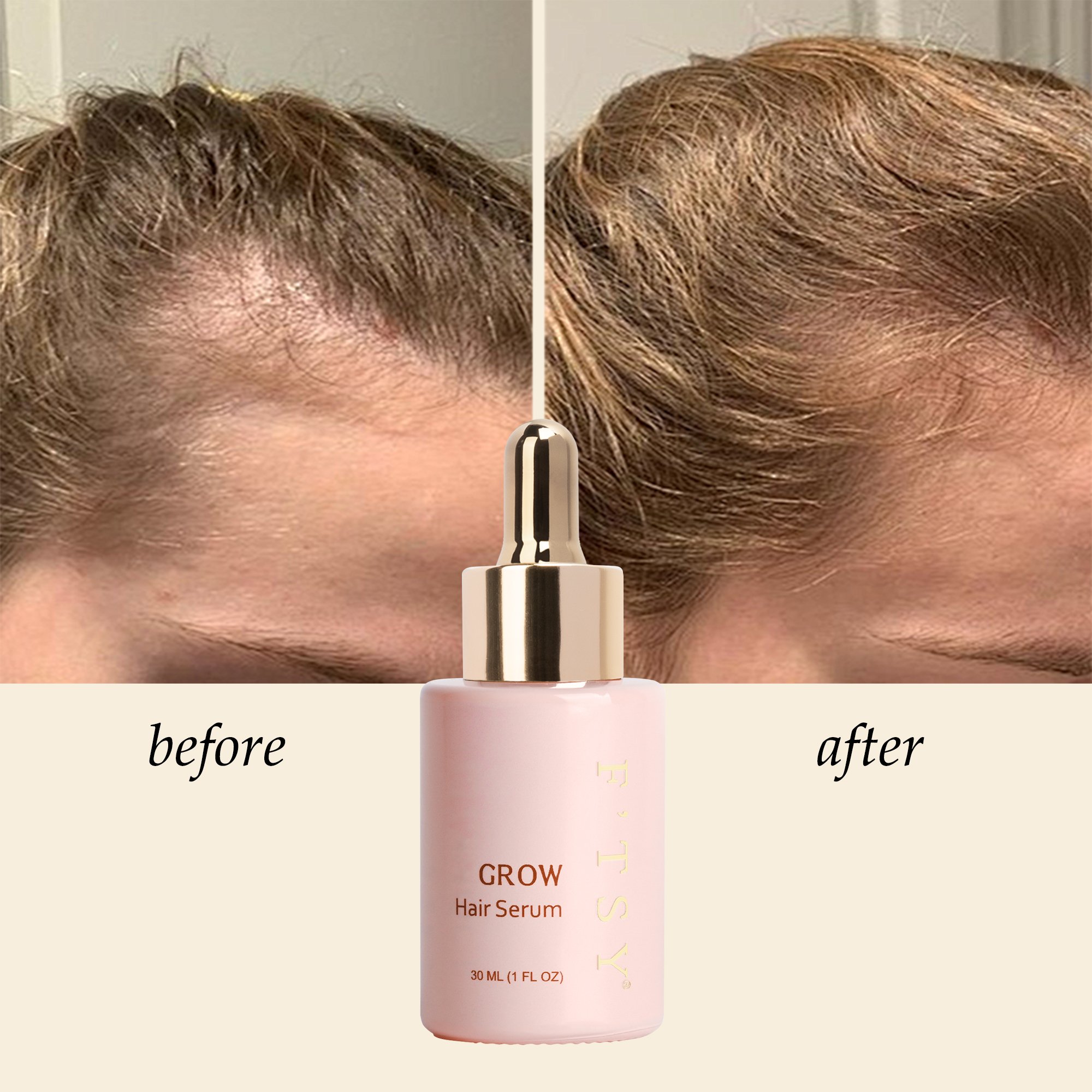 30ml Organic Formula Hair Serum Nourishing, Fuller Looking & Get Thicker Hair,Hair Growth Serum
