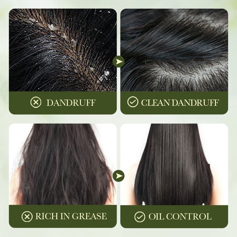 SADOER Wholesale Natural Olive Oil Anti-dandruff Repair Hair Smoothing cleansing Shampoo for Hair Care