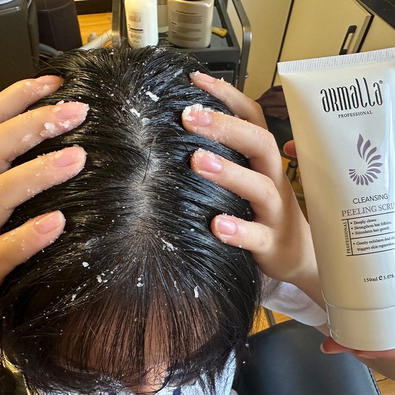 Private Label Anti Dandruff Hair Shampoo Scalp Care Detox Treatment Peeling Rosemary Mint Clarifying Hair Scalp Scrub