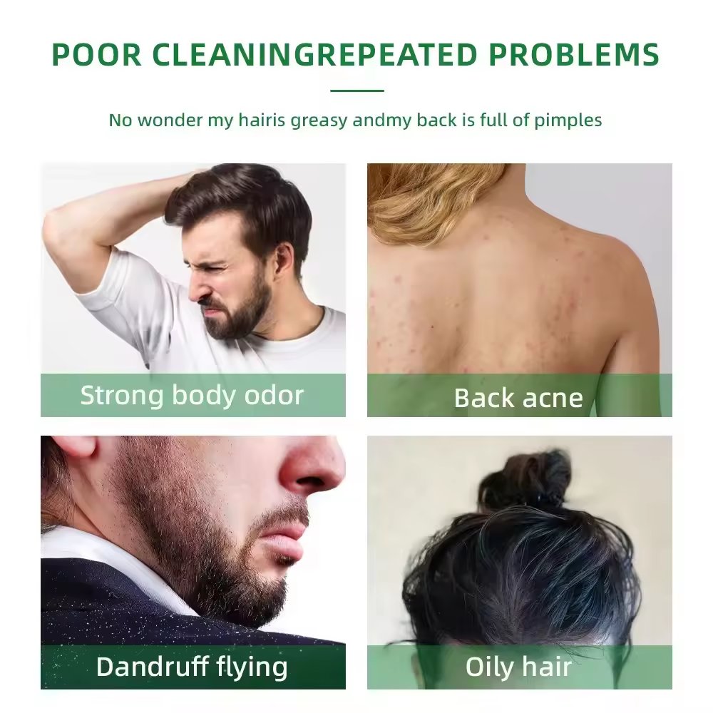 Wholesale natural hair grow shampoo hair loss organic ginger mint tea tree oil shampoo hair growth oil shampoo for men and women