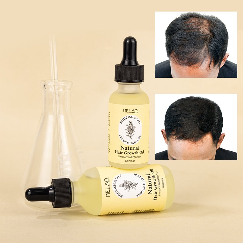 Hair Serum Hair Care Essential Oil Natural Hair Growth Oil