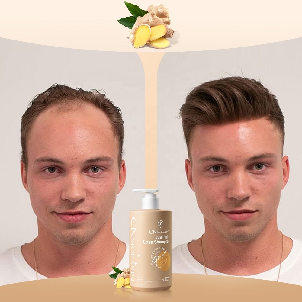 Chinese factory private label ginger anti hair loss shampoo
