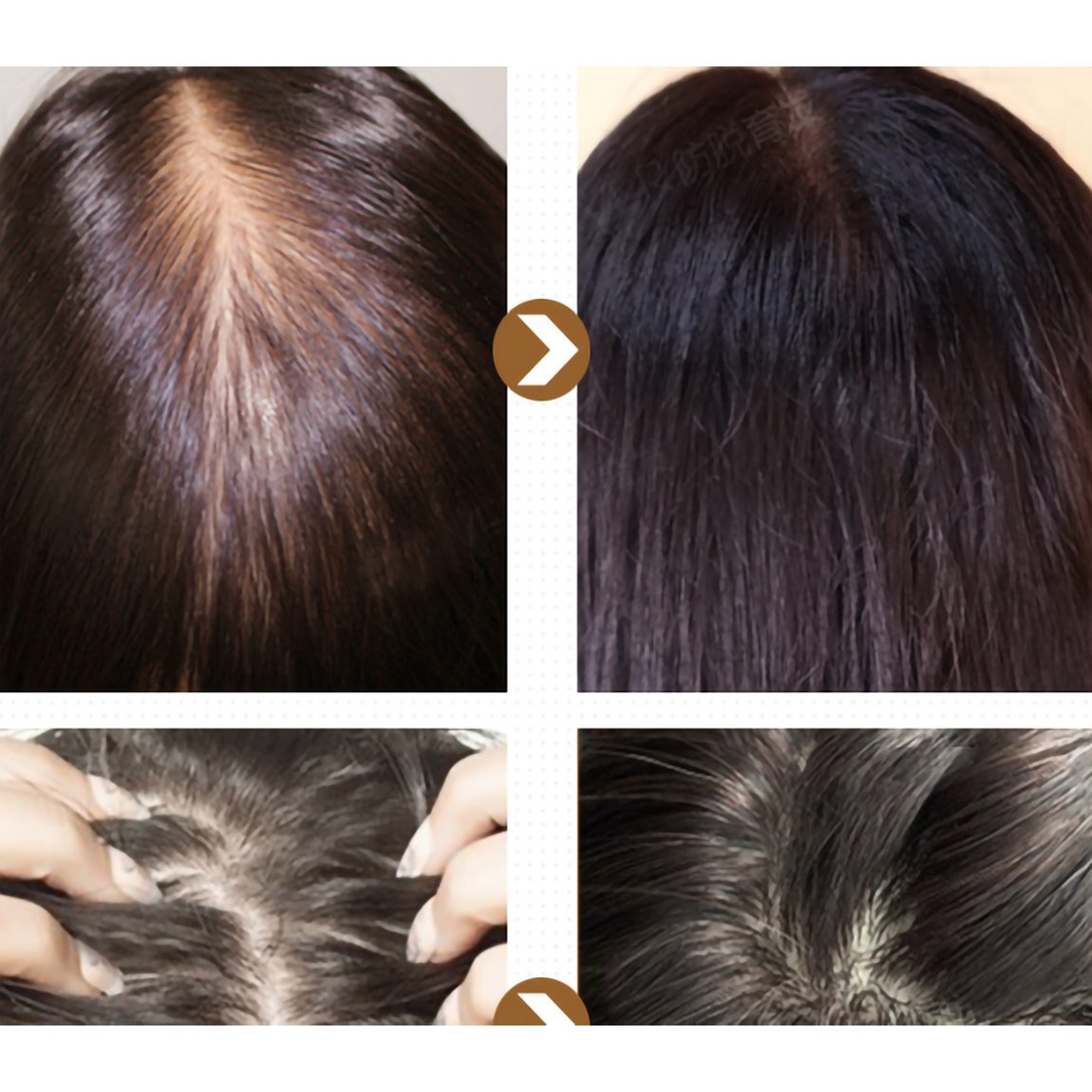 Chinese OEM Hot Sale Tonic Hair Growth Oil Anti-Hair Loss Regrowth Scalp Treatment Oil Hair Scalp Care Oil
