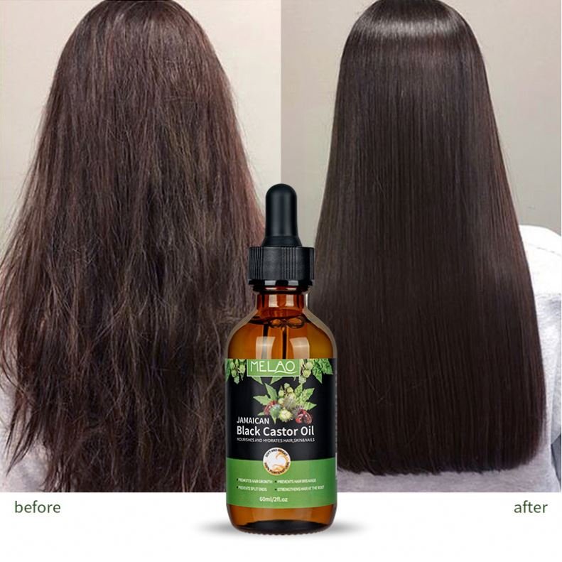 China Factory Natural Rosemary Growth, Multipurpose For And Skin, Eyebrow, Body Care Hair Growth Castor Oil