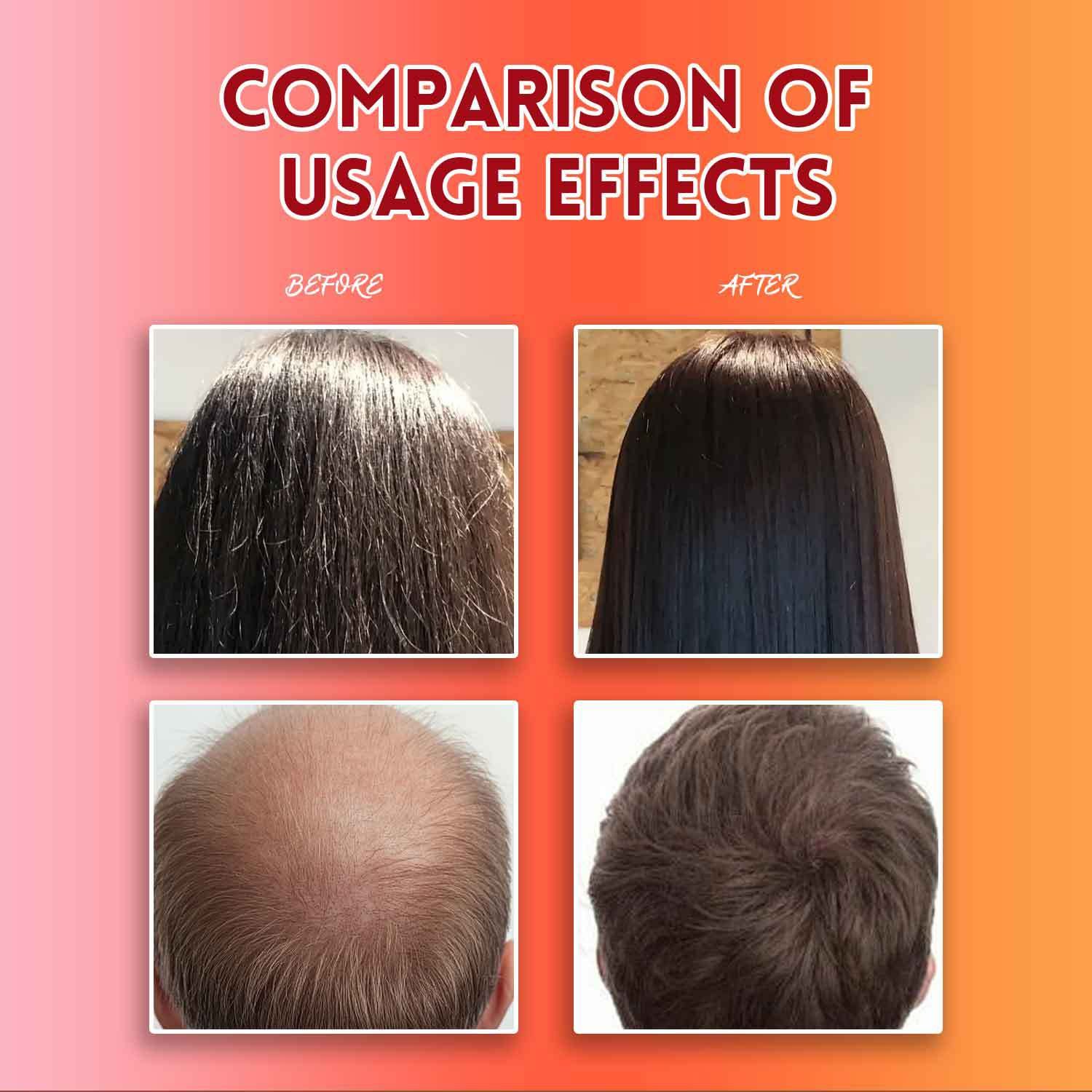 Batana Oil Hair Growth Shampoo Natural Hair Loss Shampoo for Thinning Hair Women and Men