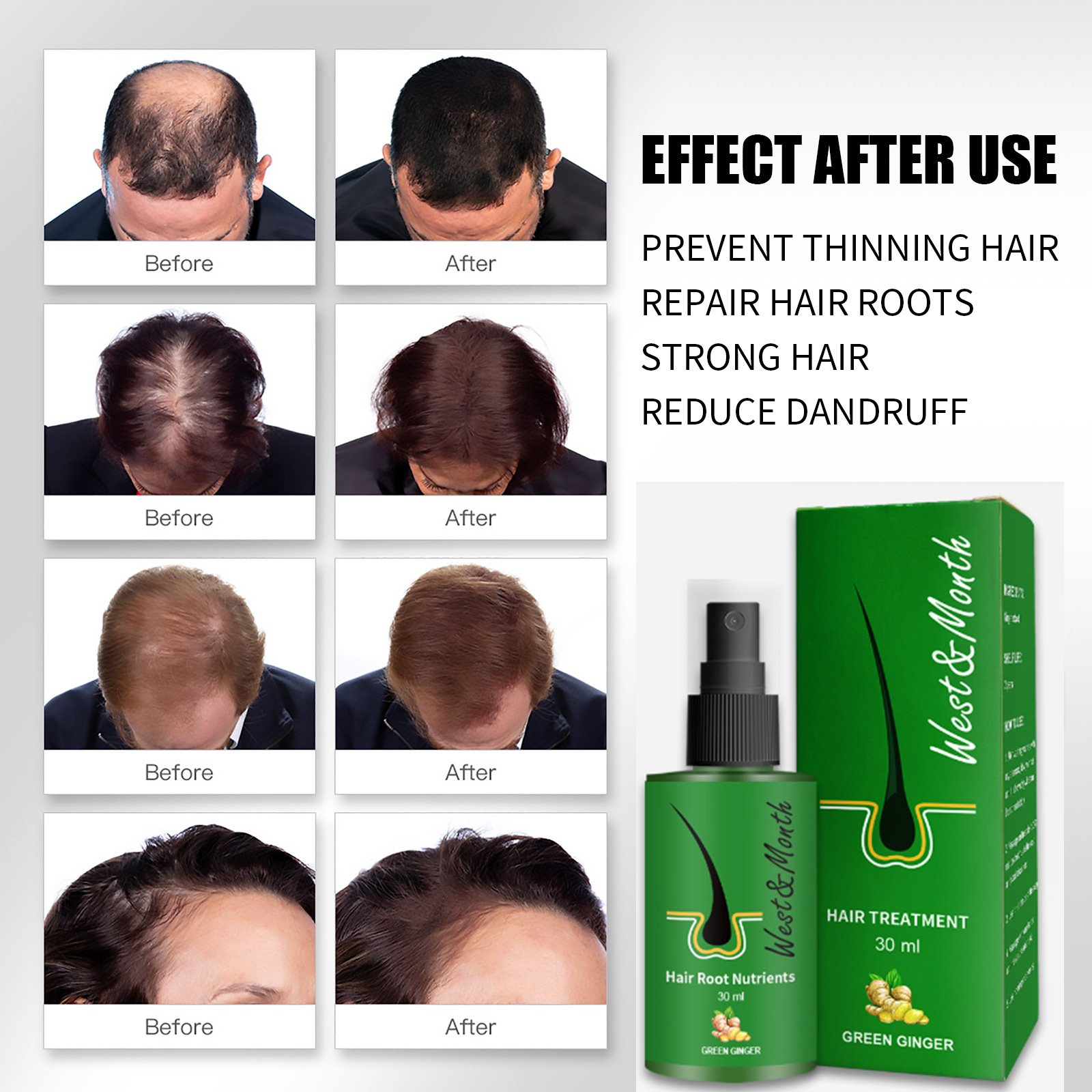 organic man Women hair care herbal regrowth anti loss Gingseng biotin Hair Growth Oil green Ginger hair root nutrients Spray