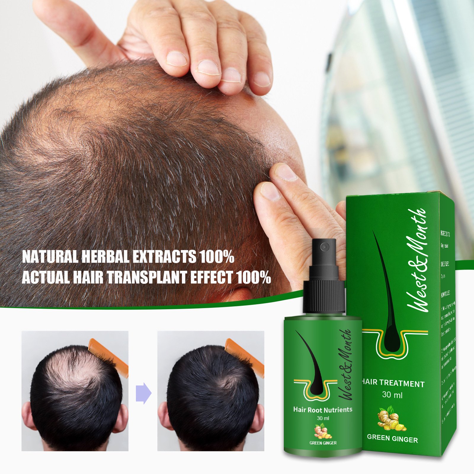 organic man Women hair care herbal regrowth anti loss Gingseng biotin Hair Growth Oil green Ginger hair root nutrients Spray