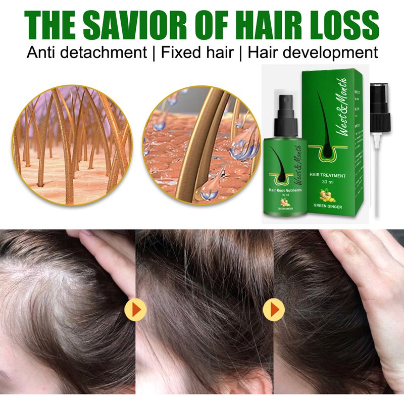 organic man Women hair care herbal regrowth anti loss Gingseng biotin Hair Growth Oil green Ginger hair root nutrients Spray