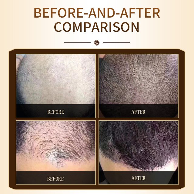 Private Label Best Quality 418ml Anti-Loss Hair Shampoo Prevent Hair Loss Anti-dandruff Shampoo Natural Herbal Extract Shampoo
