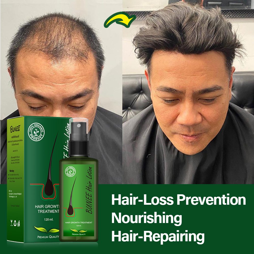 BUNEE 100ml Promote hair regrowth anti loss Gingseng herbal biotin hair growth serum for private label