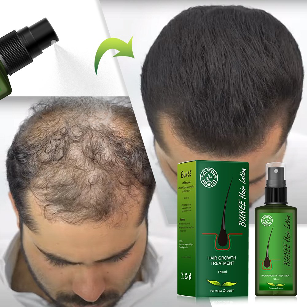 BUNEE 100ml Promote hair regrowth anti loss Gingseng herbal biotin hair growth serum for private label