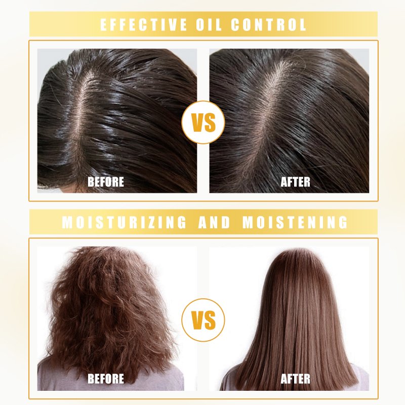 Wholesale Nourish Cleansing Private Label Hair Loss Tea Tree Oil Hair Growth Shampoo
