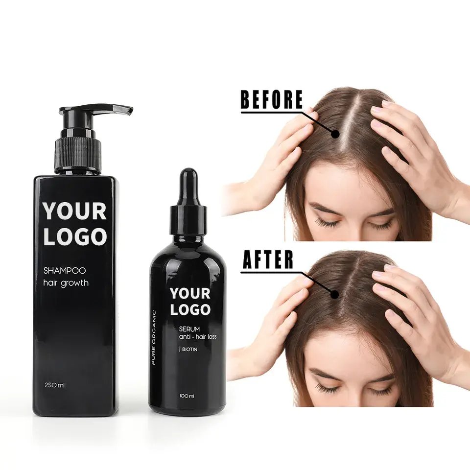 China Supplier Private Label Natural Biotin Ginger Hairloss Treatment Serum for Growth