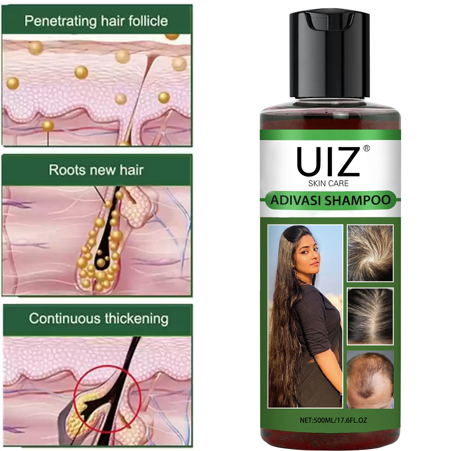 Adivasi Herbal Hair Growth Shampoo And Conditioner Repair Anti Hair Loss Treatment Thicker Oil Hair Regrowth Care Set