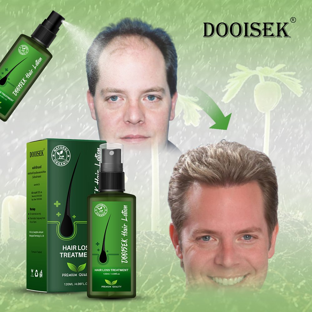 120ml New Dooisek Hair Lotion Hair Regrowth Treatment of hair loss tonic Growth Serum Oil Lotion for men