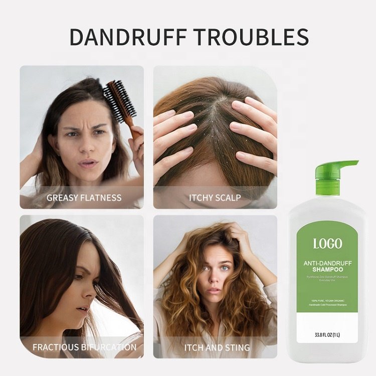 Guangzhou Factory Customize Logo Acidic Collagen Skin Friendly No Dandruff Hair Care Shampoo
